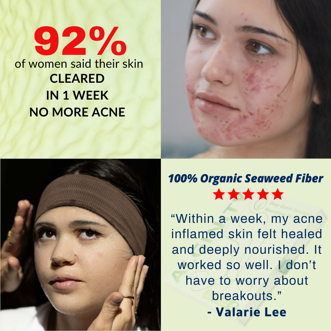 Alginity™ Deep Ocean Seaweed Acne Rescue Mask (pack of 6)