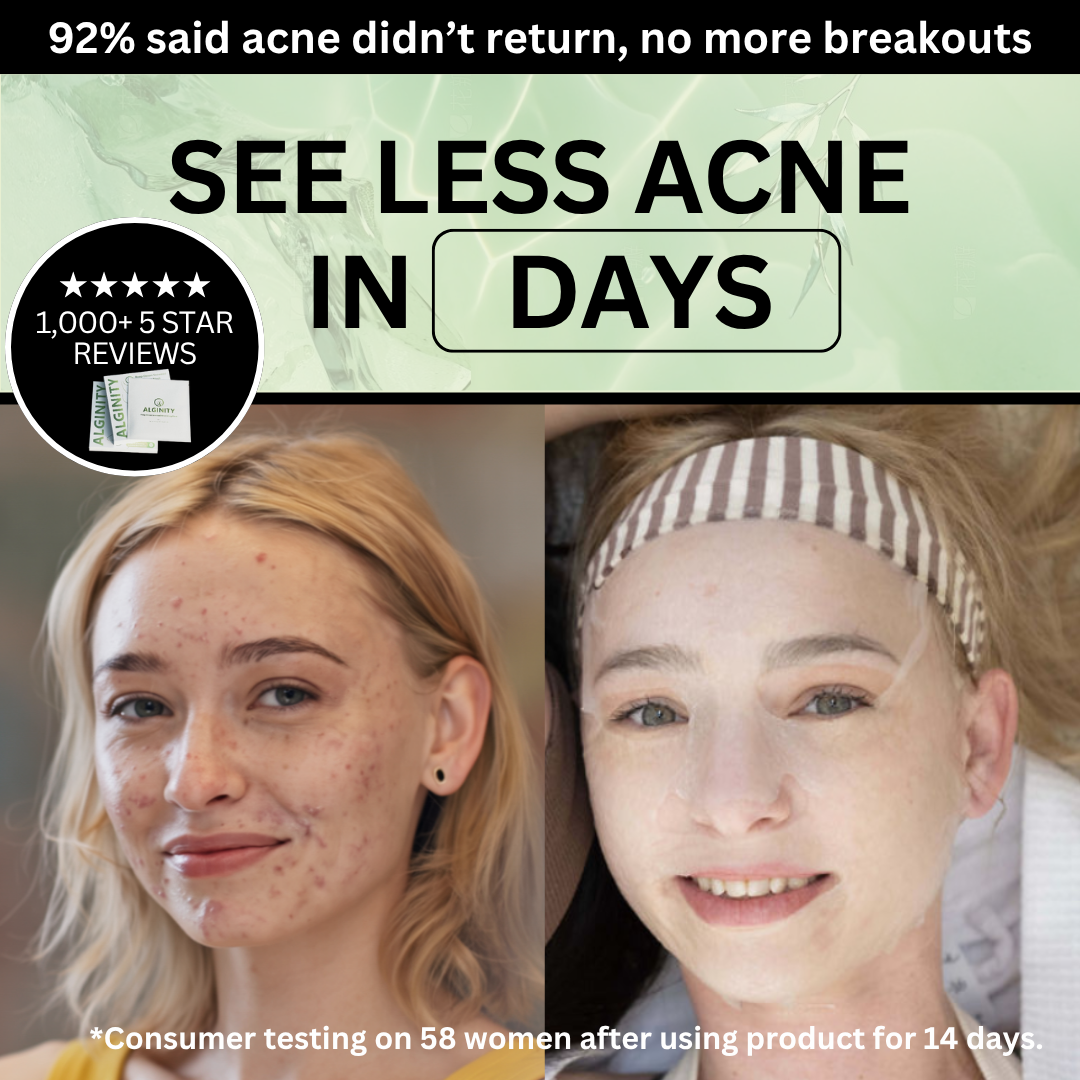 Alginity™ Deep Ocean Seaweed Acne Rescue Mask (pack of 6)