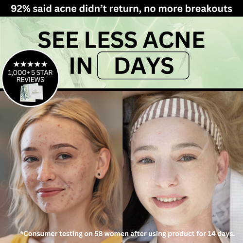 Alginity™ Deep Ocean Seaweed Acne Rescue Mask (pack of 6)