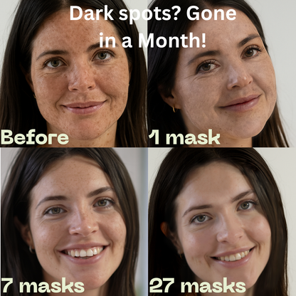 Alginity™ Deep Ocean Seaweed Spot Remover Mask (pack of 6)